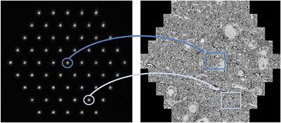 Multi-Beam Scanning Electron Microscopy for High-Throughput Imaging in Connectomics Research